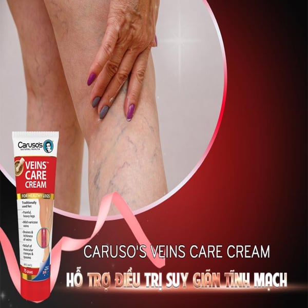 Kem bôi hỗ trợ cải thiện suy giãn tĩnh mạch Caruso's Veins Care Cream của Úc 75g - Image 4